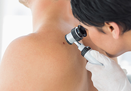 Skin Checks Skin Checks